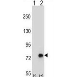 Transforming Growth Factor Beta Induced Protein (TGFBI) Antibody