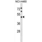 KICSTOR Complex Protein Kaptin (KPTN) Antibody