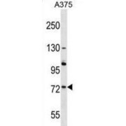 Acyl-CoA Oxidase 2 (ACOX2) Antibody