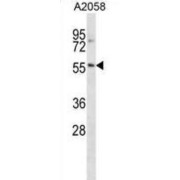 Nucleus Accumbens-Associated Protein 2 (NACC2) Antibody