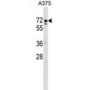 USP17L2 Antibody