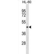 Tektin 1 (TEKT1) Antibody