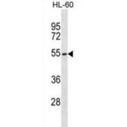Beta-1,4-Mannosyl-Glycoprotein 4-Beta-N-Acetylglucosaminyltransferase (MGAT3) Antibody