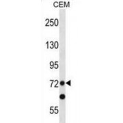 PR Domain Zinc Finger Protein 8 (PRDM8) Antibody