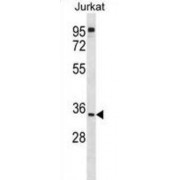 Western blot analysis of Jurkat cell lysates (35 µg per lane) using UBX Domain-Containing Protein 8 (UBXN8) Antibody.