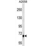 Rho Guanine Nucleotide Exchange Factor 5 (ARHGEF5) Antibody