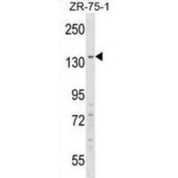 Regulatory Factor X1 (RFX1) Antibody