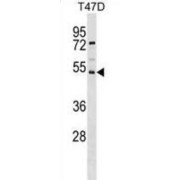 Putative Transporter SVOPL (SVOPL) Antibody