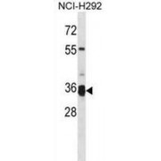 Transmembrane Protease Serine 12 (TMPRSS12) Antibody