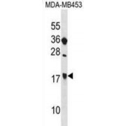 Signaling Threshold Regulating Transmembrane Adaptor 1 (SIT1) Antibody