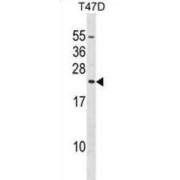 Eukaryotic Translation Initiation Factor 3 Subunit K (EIF3K) Antibody