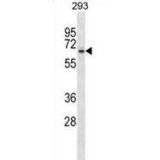 Sushi Repeat Containing Protein, X-Linked (SRPX) Antibody