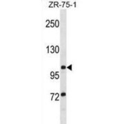 Tubulin Polyglutamylase TTLL8 (TTLL8) Antibody