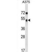 Septin 11 (SEPTIN11) Antibody