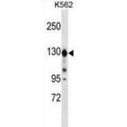 Extended Synaptotagmin-1 (ESYT1) Antibody