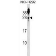 Tetraspanin 2 (TSPAN2) Antibody