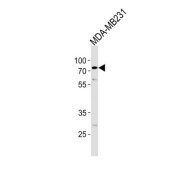 Tripartite Motif Containing 25 (TRIM25) Antibody