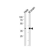 Cyclic AMP-Dependent Transcription Factor ATF-2 (ATF2) Antibody