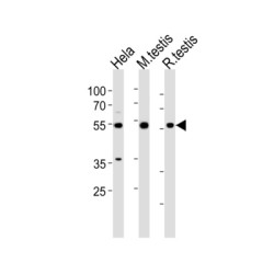 Histone Deacetylase 1 (HDAC1) Antibody