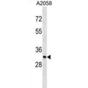 Monoglyceride Lipase (MGLL) Antibody