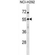 Ubiquitin Carboxyl-Terminal Hydrolase 27 (USP27X) Antibody