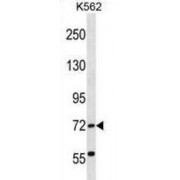ATP Binding Cassette Subfamily F Member 2 (ABCF2) Antibody