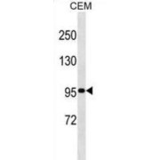 Ubiquitin Carboxyl-Terminal Hydrolase 1 (USP1) Antibody