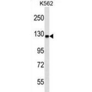 Ubiquitin-Like Modifier-Activating Enzyme 6 (UBA6) Antibody
