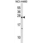 MOB Family Member 4, Phocein (MOBKL3) Antibody