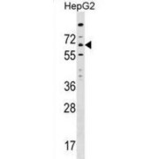 Inositol 1,4,5-Trisphosphate Receptor-Interacting Protein-Like 1 (ITPRIPL1) Antibody