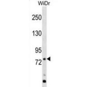 Probable G-Protein Coupled Receptor 149 (GPR149) Antibody