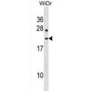 Lysozyme-Like Protein 6 (LYZL6) Antibody