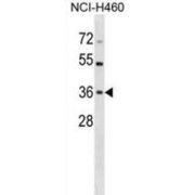 Checkpoint Protein HUS1 (HUS1) Antibody