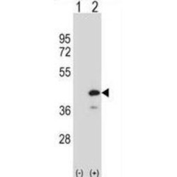 Protein Tyrosine Phosphatase, Non Receptor Type 18 (PTPN18) Antibody