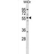 Asparagine Synthetase (ASNS) Antibody