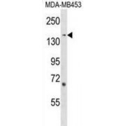 Rho Guanine Nucleotide Exchange Factor 11 (ARHGEF11) Antibody
