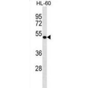 Drebrin-Like Protein (DBNL) Antibody