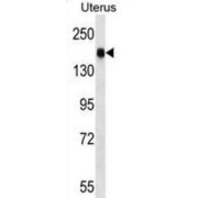 Cingulin-Like Protein 1 (CGNL1) Antibody