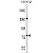 Zinc Finger Protein 540 (ZNF540) Antibody
