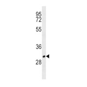 B-Lymphocyte Antigen CD20 (MS4A1) Antibody