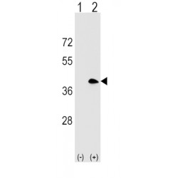 B-Lymphocyte Antigen CD20 (MS4A1) Antibody