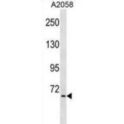 TNFAIP3-Interacting Protein 1 (TNIP1) Antibody