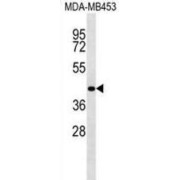 RNA Binding Motif Protein 4 (RBM4) Antibody