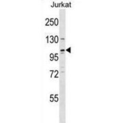 RE1 Silencing Transcription Factor (REST) Antibody