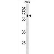 Zinc Finger And BTB Domain-Containing Protein 7B (ZBTB7B) Antibody