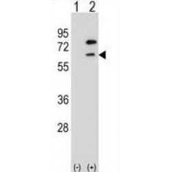 Zinc Finger And BTB Domain-Containing Protein 7B (ZBTB7B) Antibody