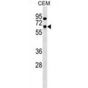 U1 Small Nuclear Ribonucleoprotein 70 kDa (SNRNP70) Antibody