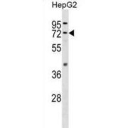 Fatty-Acid Amide Hydrolase 1 (FAAH) Antibody