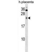 Histone Deacetylase Complex Subunit SAP30 (SAP30) Antibody