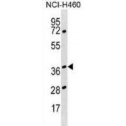 Heterogeneous Nuclear Ribonucleoprotein H3 (HNRNPH3) Antibody